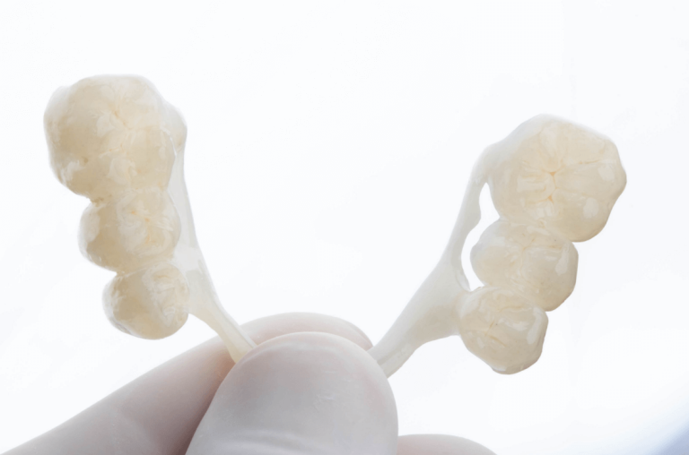 Caso clínico prótese