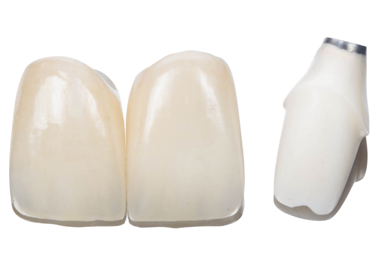 Caso clínico prótese